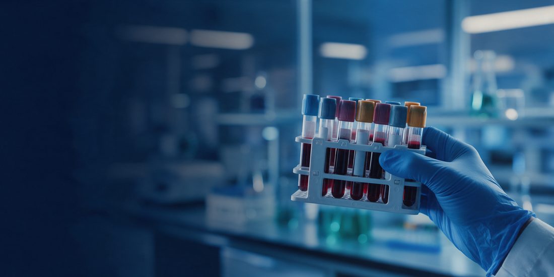 Mano con guante sosteniendo tubos de muestra de sangre en un laboratorio