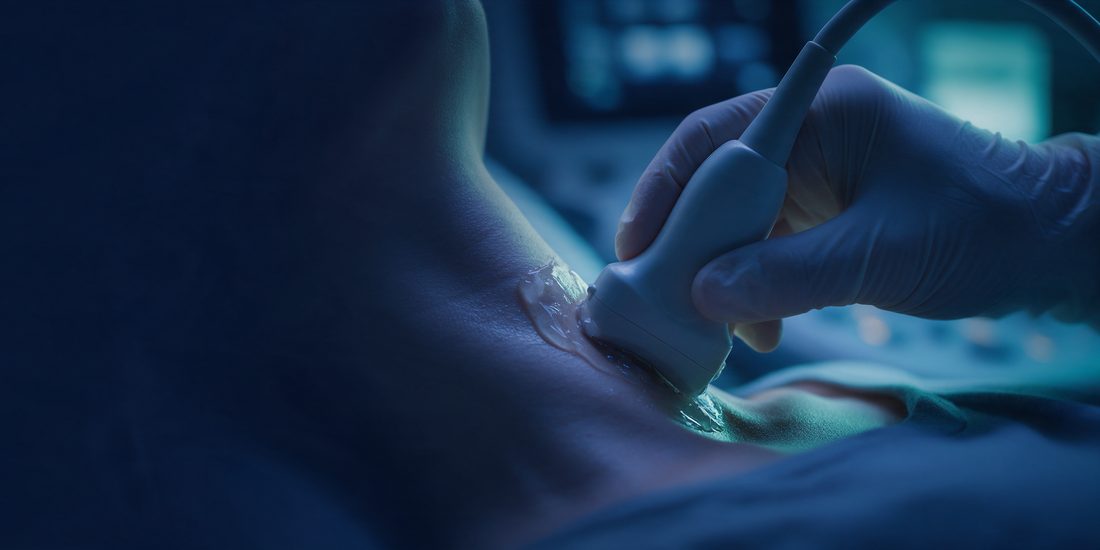 Ultrasonido de tiroides: transductor sobre el cuello de un paciente